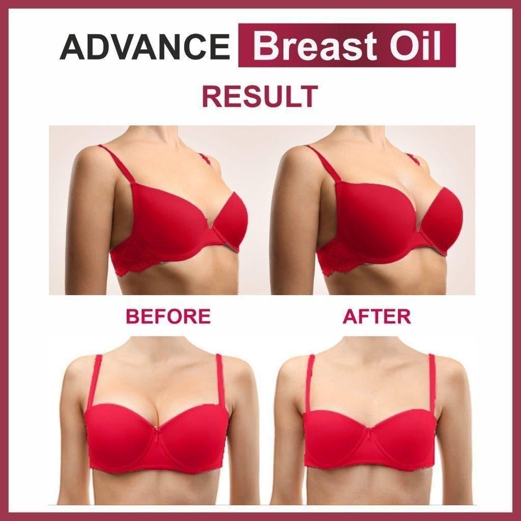 ADVANCE BREAST OIL(Pack of 2)